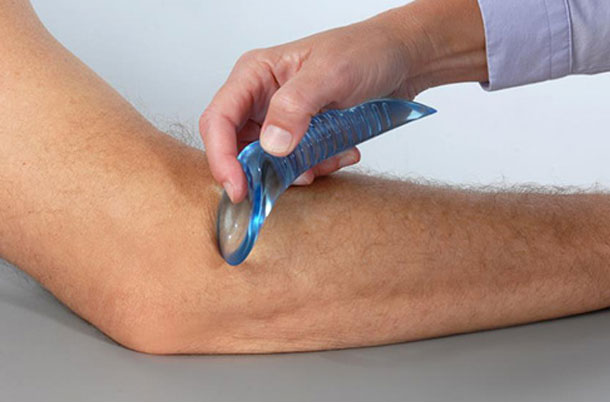 ASTYM image being used on a patient's arm