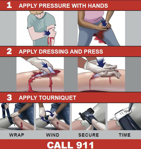 An instructional infographic featuring a three-step emergency guide: 1) apply direct pressure with hands, 2) apply dressing and press, and 3) apply a tourniquet using the wrap, wind, secure, and time method, ending with a call to dial 911